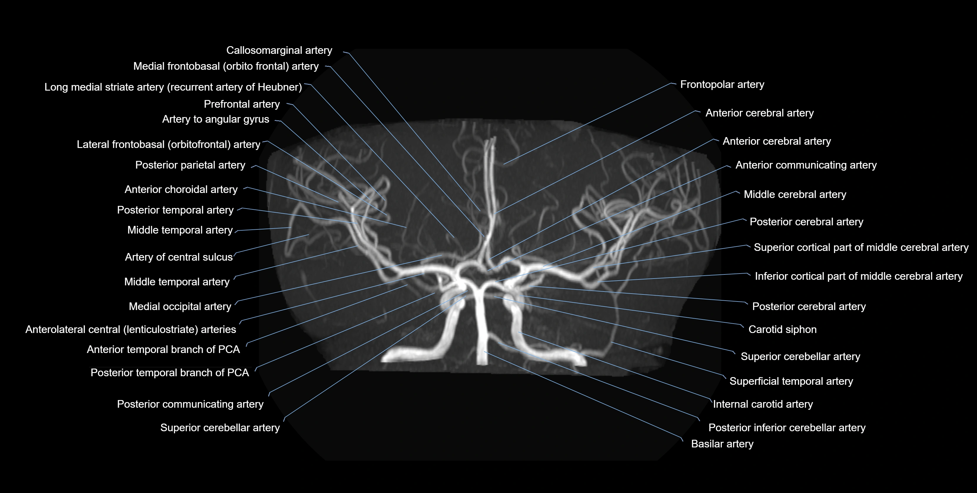 MRA brain axial MIP labelled  anatomy 3T MRI images -img-01021-00008.webp